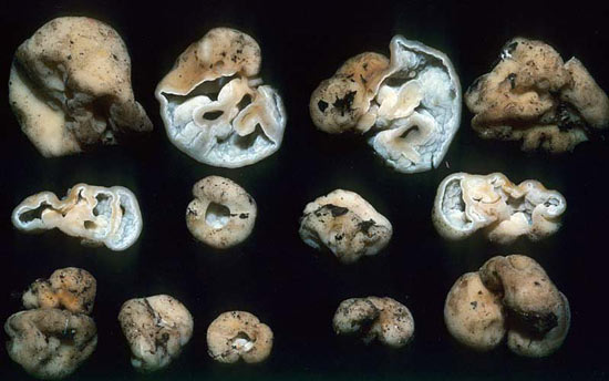 Hydnotrya variiformis - Mushroom Species Images